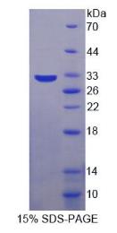 SDS-PAGE (PRKDC-1774M).jpg
